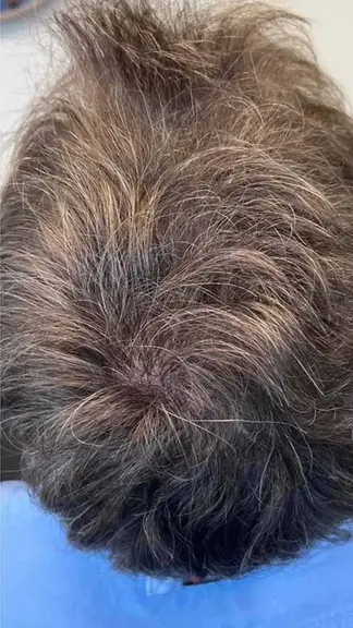 Hair After