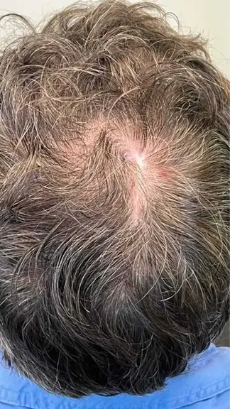 Hair Before