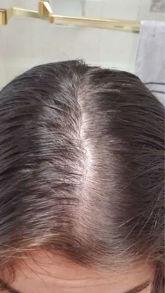 Hair Before